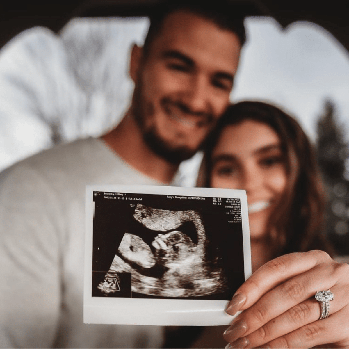 Steelers QB Mitch Trubisky and his wife welcome baby boy